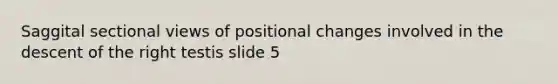 Saggital sectional views of positional changes involved in the descent of the right testis slide 5