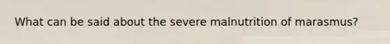 What can be said about the severe malnutrition of marasmus?
