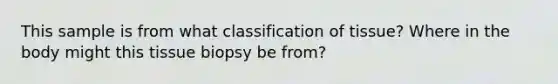 This sample is from what classification of tissue? Where in the body might this tissue biopsy be from?