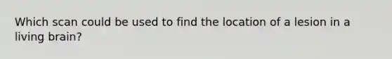 Which scan could be used to find the location of a lesion in a living brain?