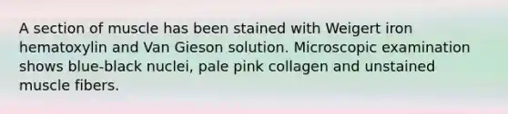 A section of muscle has been stained with Weigert iron hematoxylin and Van Gieson solution. Microscopic examination shows blue-black nuclei, pale pink collagen and unstained muscle fibers.