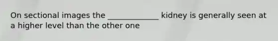 On sectional images the _____________ kidney is generally seen at a higher level than the other one