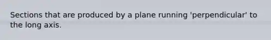 Sections that are produced by a plane running 'perpendicular' to the long axis.