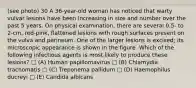 (see photo) 30 A 36-year-old woman has noticed that warty vulvar lesions have been increasing in size and number over the past 5 years. On physical examination, there are several 0.5- to 2-cm, red-pink, flattened lesions with rough surfaces present on the vulva and perineum. One of the larger lesions is excised; its microscopic appearance is shown in the figure. Which of the following infectious agents is most likely to produce these lesions? □ (A) Human papillomavirus □ (B) Chlamydia trachomatis □ (C) Treponema pallidum □ (D) Haemophilus ducreyi □ (E) Candida albicans