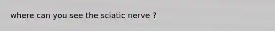 where can you see the sciatic nerve ?