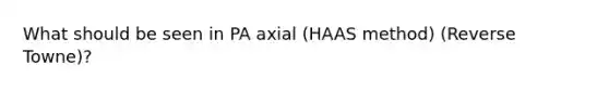 What should be seen in PA axial (HAAS method) (Reverse Towne)?