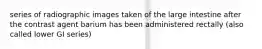 series of radiographic images taken of the large intestine after the contrast agent barium has been administered rectally (also called lower GI series)
