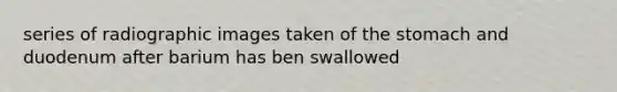 series of radiographic images taken of the stomach and duodenum after barium has ben swallowed