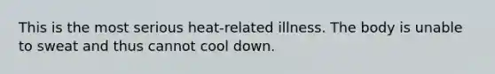 This is the most serious heat-related illness. The body is unable to sweat and thus cannot cool down.