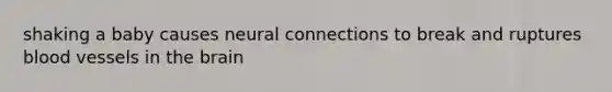 shaking a baby causes neural connections to break and ruptures blood vessels in the brain