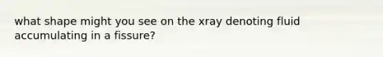 what shape might you see on the xray denoting fluid accumulating in a fissure?