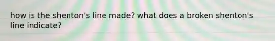 how is the shenton's line made? what does a broken shenton's line indicate?