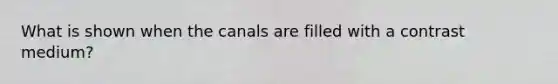 What is shown when the canals are filled with a contrast medium?