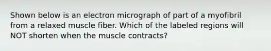 Shown below is an electron micrograph of part of a myofibril from a relaxed muscle fiber. Which of the labeled regions will NOT shorten when the muscle contracts?