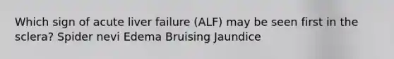 Which sign of acute liver failure (ALF) may be seen first in the sclera? Spider nevi Edema Bruising Jaundice