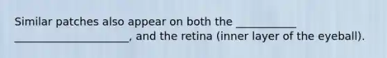 Similar patches also appear on both the ___________ _____________________, and the retina (inner layer of the eyeball).