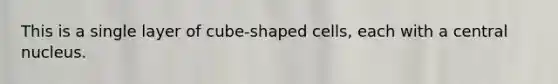 This is a single layer of cube-shaped cells, each with a central nucleus.