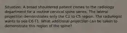 Situation: A broad shouldered patient comes to the radiology department for a routine cervical spine series. The lateral projection demonstrates only the C1 to C5 region. The radiologist wants to see C6-T1. What additional projection can be taken to demonstrate this region of the spine?