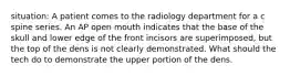 situation: A patient comes to the radiology department for a c spine series. An AP open mouth indicates that the base of the skull and lower edge of the front incisors are superimposed, but the top of the dens is not clearly demonstrated. What should the tech do to demonstrate the upper portion of the dens.