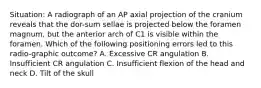 Situation: A radiograph of an AP axial projection of the cranium reveals that the dor-sum sellae is projected below the foramen magnum, but the anterior arch of C1 is visible within the foramen. Which of the following positioning errors led to this radio-graphic outcome? A. Excessive CR angulation B. Insufficient CR angulation C. Insufficient flexion of the head and neck D. Tilt of the skull