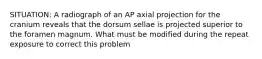 SITUATION: A radiograph of an AP axial projection for the cranium reveals that the dorsum sellae is projected superior to the foramen magnum. What must be modified during the repeat exposure to correct this problem