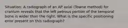 Situation: A radiograph of an AP axial (Towne method) for cranium reveals that the left petrous portion of the temporal bone is wider than the right. What is the specific positioning error present on this radiograph?