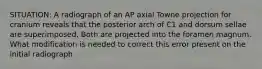 SITUATION: A radiograph of an AP axial Towne projection for cranium reveals that the posterior arch of C1 and dorsum sellae are superimposed. Both are projected into the foramen magnum. What modification is needed to correct this error present on the initial radiograph