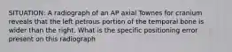 SITUATION: A radiograph of an AP axial Townes for cranium reveals that the left petrous portion of the temporal bone is wider than the right. What is the specific positioning error present on this radiograph