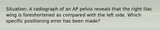 Situation: A radiograph of an AP pelvis reveals that the right iliac wing is foreshortened as compared with the left side. Which specific positioning error has been made?