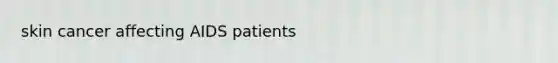 skin cancer affecting AIDS patients