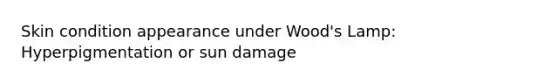 Skin condition appearance under Wood's Lamp: Hyperpigmentation or sun damage