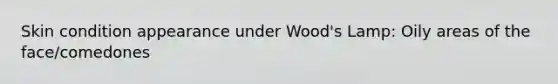 Skin condition appearance under Wood's Lamp: Oily areas of the face/comedones