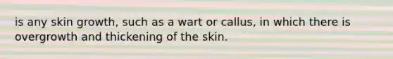 is any skin growth, such as a wart or callus, in which there is overgrowth and thickening of the skin.