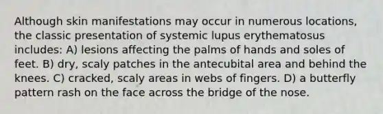 Although skin manifestations may occur in numerous locations, the classic presentation of systemic lupus erythematosus includes: A) lesions affecting the palms of hands and soles of feet. B) dry, scaly patches in the antecubital area and behind the knees. C) cracked, scaly areas in webs of fingers. D) a butterfly pattern rash on the face across the bridge of the nose.