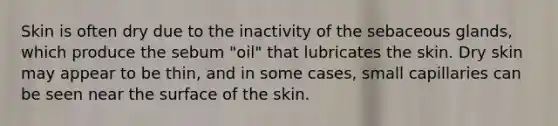 Skin is often dry due to the inactivity of the sebaceous glands, which produce the sebum "oil" that lubricates the skin. Dry skin may appear to be thin, and in some cases, small capillaries can be seen near the surface of the skin.