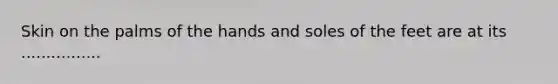 Skin on the palms of the hands and soles of the feet are at its ................