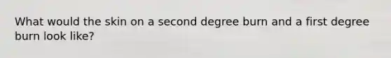 What would the skin on a second degree burn and a first degree burn look like?