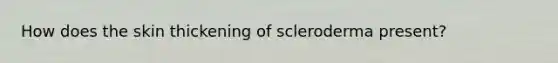 How does the skin thickening of scleroderma present?