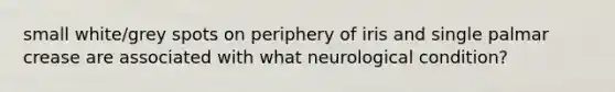 small white/grey spots on periphery of iris and single palmar crease are associated with what neurological condition?