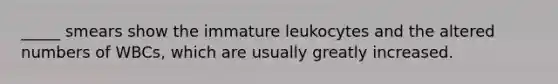 _____ smears show the immature leukocytes and the altered numbers of WBCs, which are usually greatly increased.