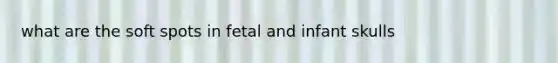 what are the soft spots in fetal and infant skulls