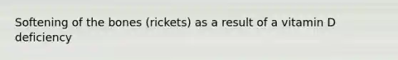 Softening of the bones (rickets) as a result of a vitamin D deficiency