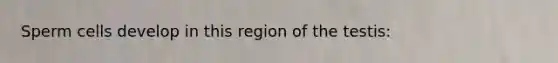 Sperm cells develop in this region of the testis: