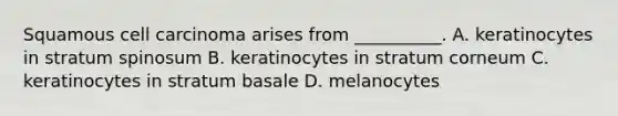 Squamous cell carcinoma arises from __________. A. keratinocytes in stratum spinosum B. keratinocytes in stratum corneum C. keratinocytes in stratum basale D. melanocytes