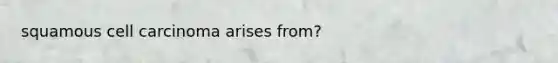 squamous cell carcinoma arises from?