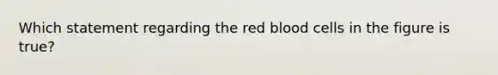 Which statement regarding the <a href='https://www.questionai.com/knowledge/kO3ylSXuZ5-red-blood-cells' class='anchor-knowledge'>red blood cells</a> in the figure is true?