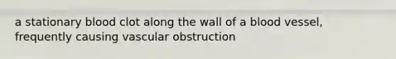 a stationary blood clot along the wall of a blood vessel, frequently causing vascular obstruction