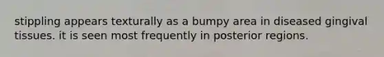 stippling appears texturally as a bumpy area in diseased gingival tissues. it is seen most frequently in posterior regions.
