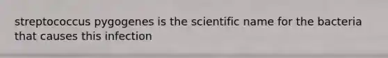 streptococcus pygogenes is the scientific name for the bacteria that causes this infection