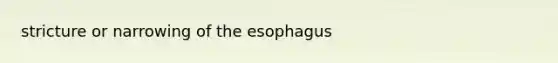 stricture or narrowing of the esophagus